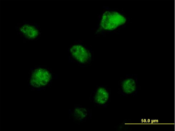 RBM6 Antibody in Immunocytochemistry (ICC/IF)