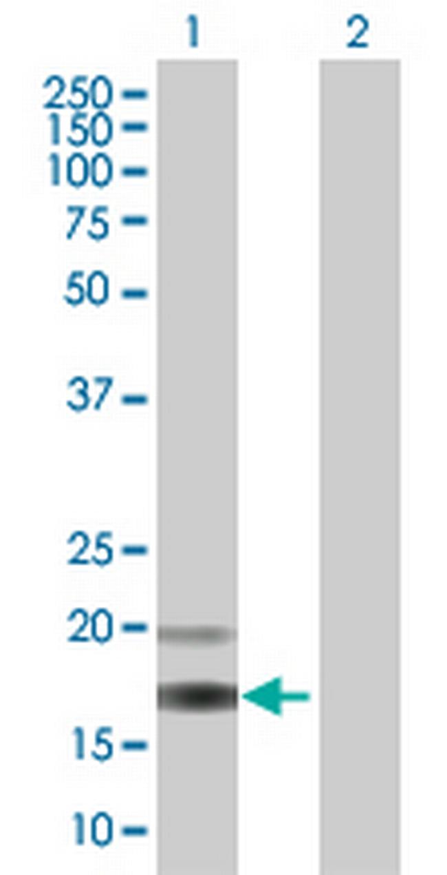 SIRPB1 Antibody in Western Blot (WB)