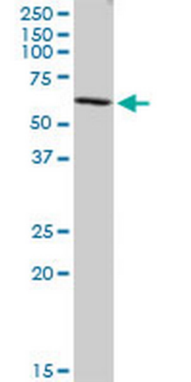 CORO2B Antibody in Western Blot (WB)