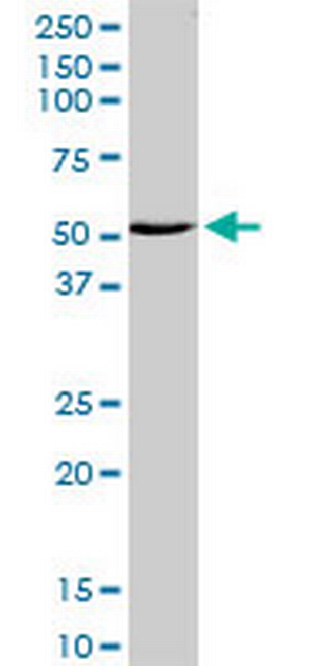 ZNF238 Antibody in Western Blot (WB)