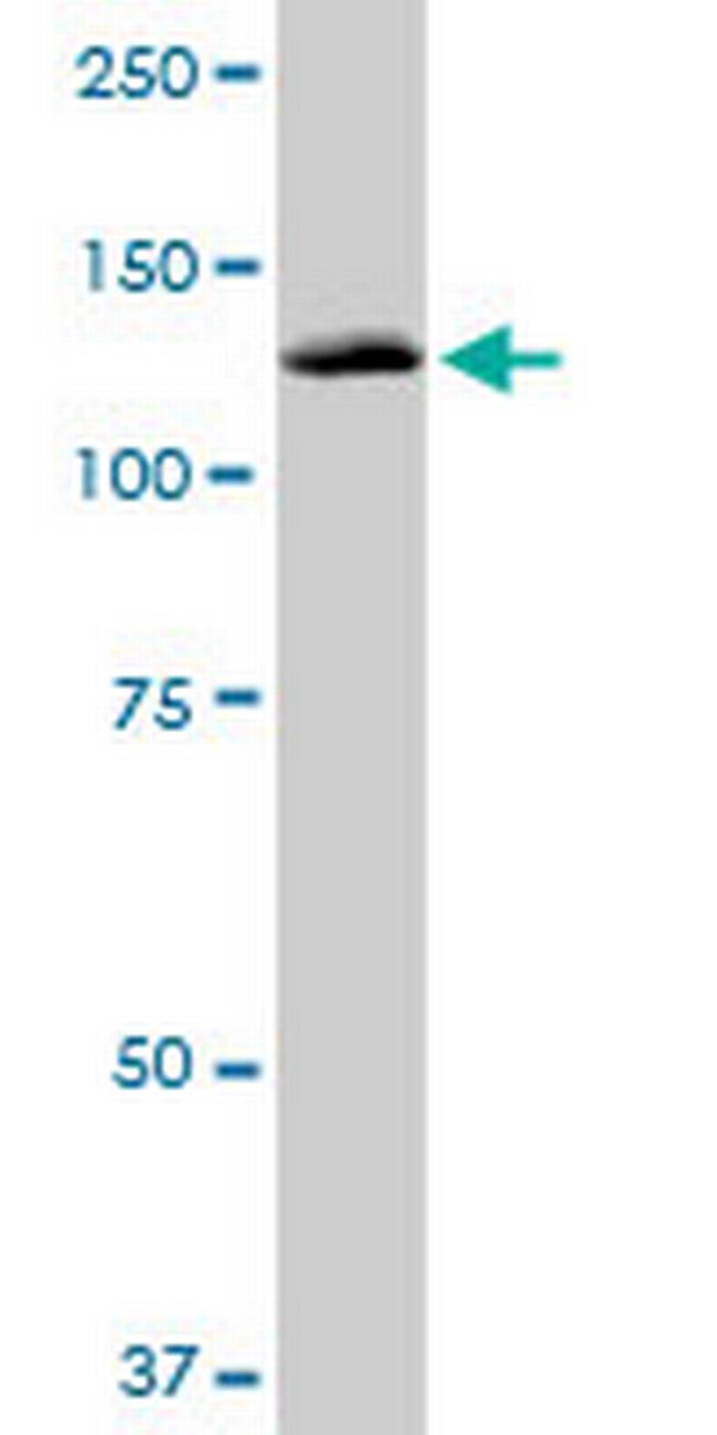 PITRM1 Antibody in Western Blot (WB)