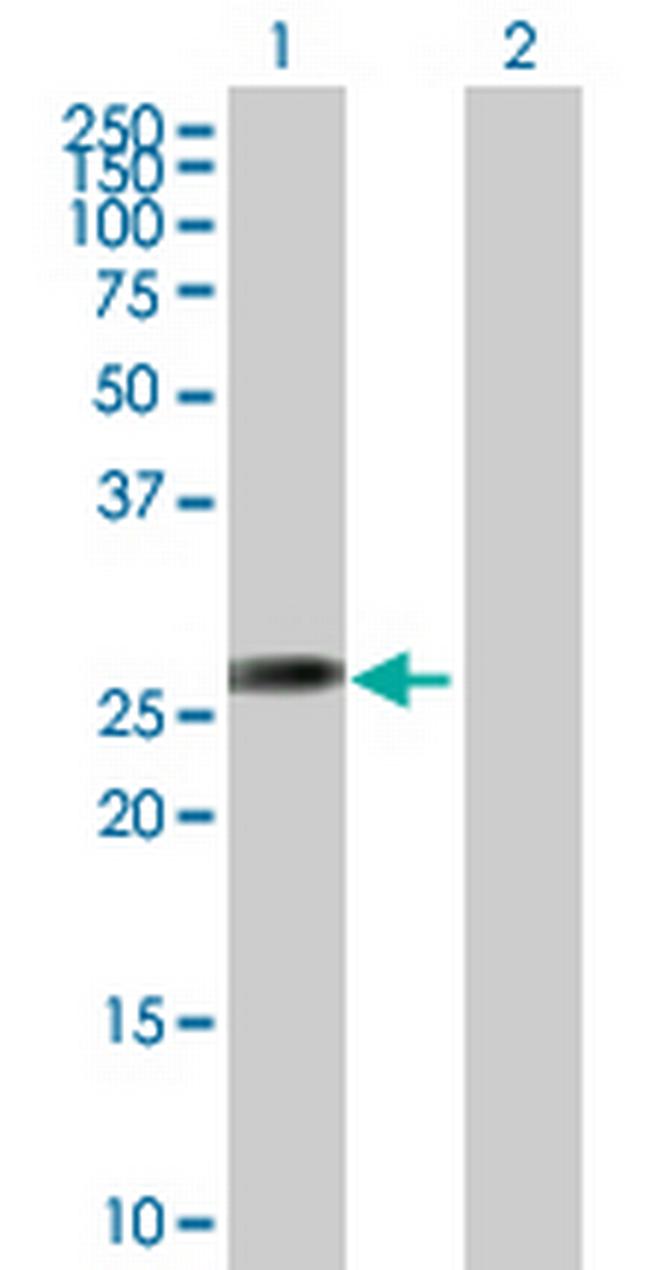 AGPAT1 Antibody in Western Blot (WB)