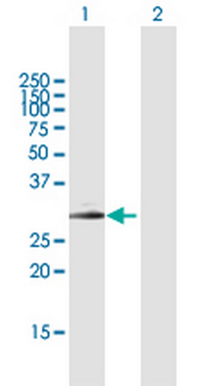 SPINT2 Antibody in Western Blot (WB)