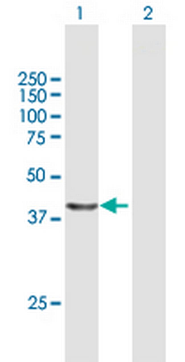 NUDC Antibody in Western Blot (WB)