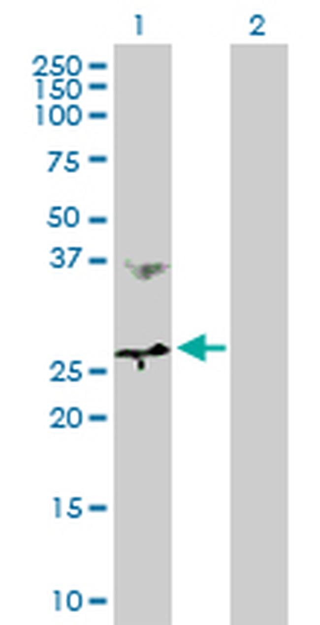 MTHFD2 Antibody in Western Blot (WB)