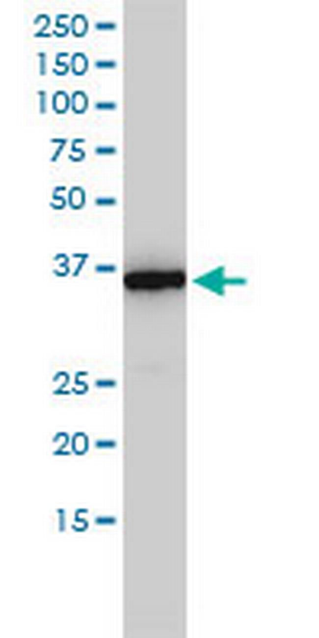 MTHFD2 Antibody in Western Blot (WB)