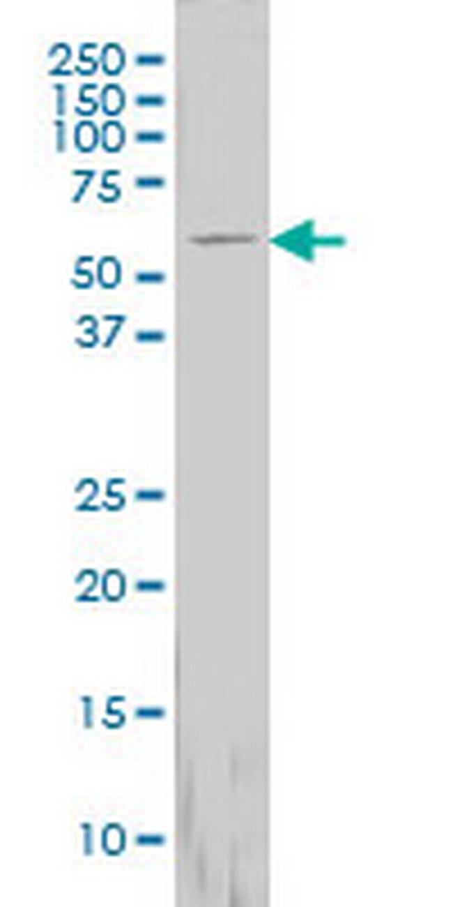 FTCD Antibody in Western Blot (WB)