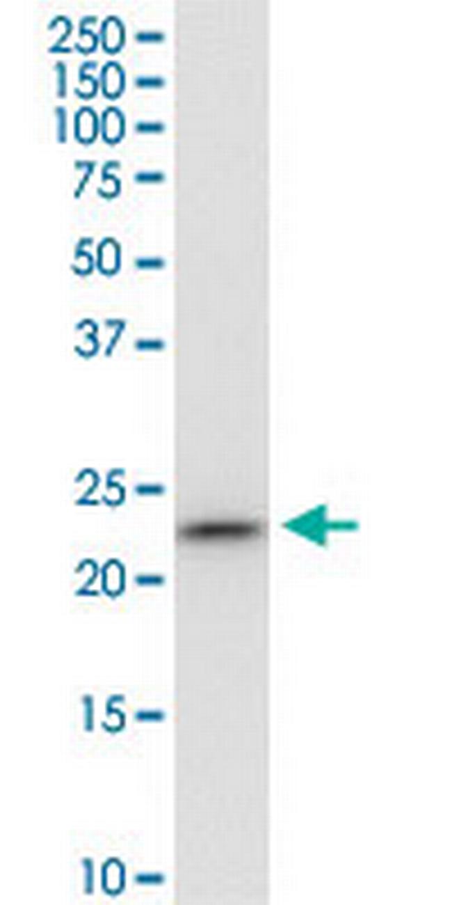 PGRMC1 Antibody in Western Blot (WB)