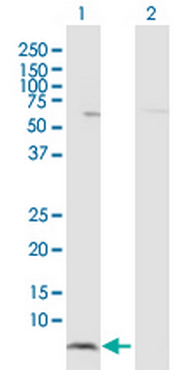 HCP5 Antibody in Western Blot (WB)