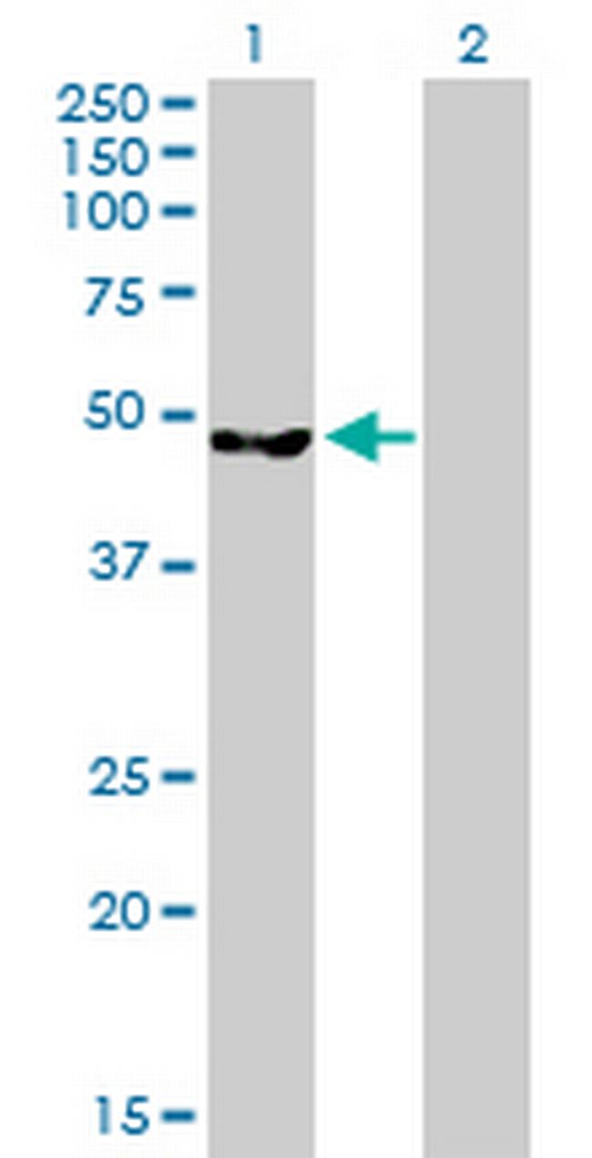 CLP1 Antibody in Western Blot (WB)