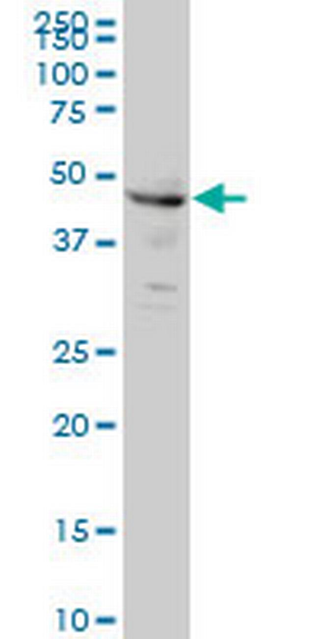 CPSF6 Antibody in Western Blot (WB)