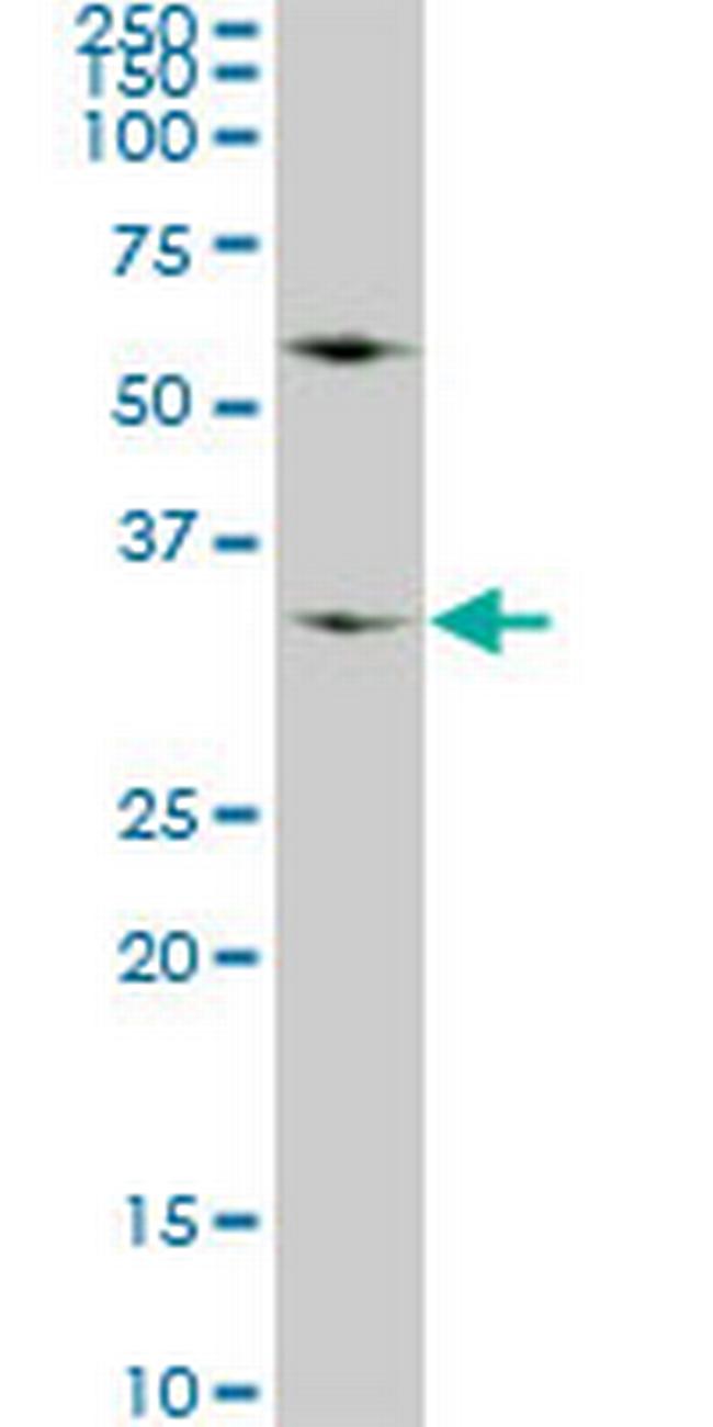 WDR5 Antibody in Western Blot (WB)