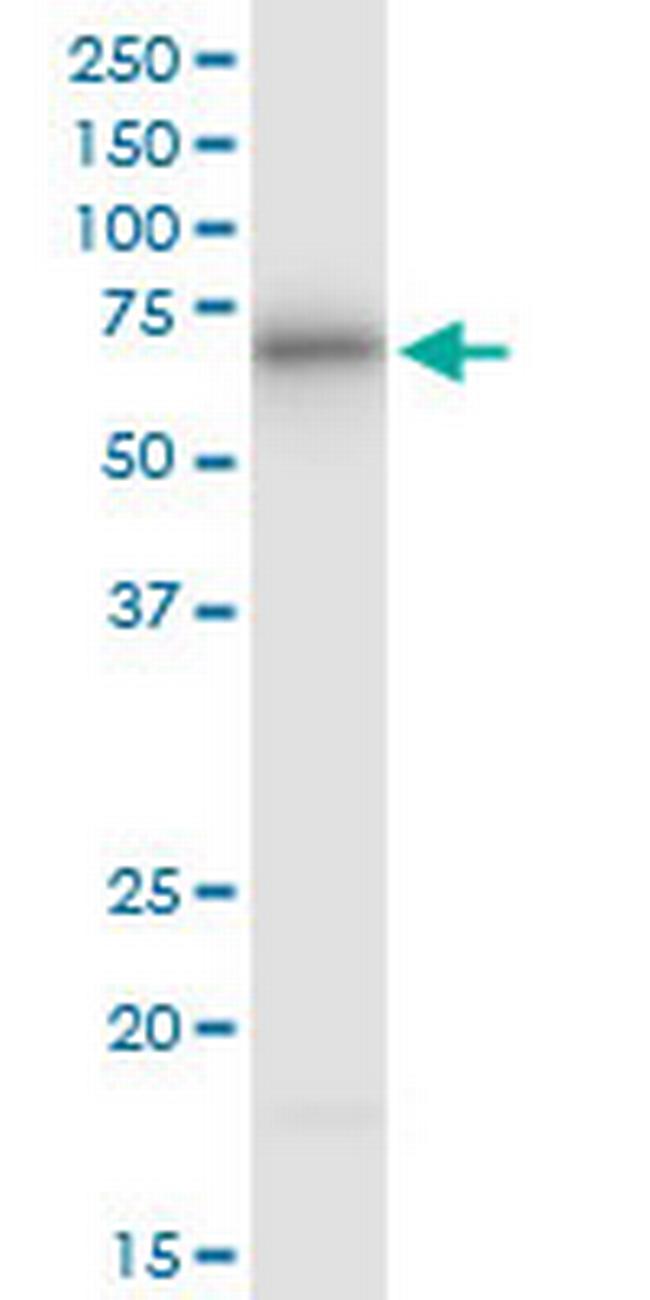 ATE1 Antibody in Western Blot (WB)