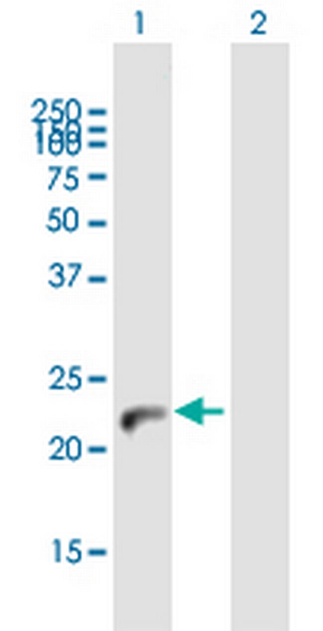 NUDT4 Antibody in Western Blot (WB)