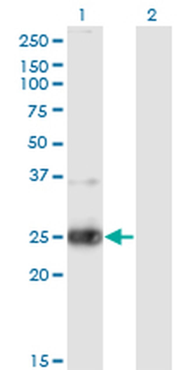 NXPH3 Antibody in Western Blot (WB)