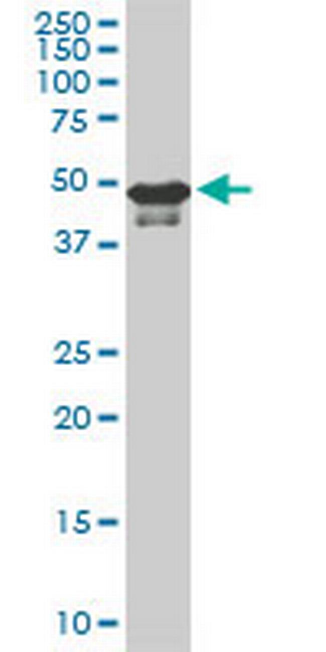 STK38 Antibody in Western Blot (WB)