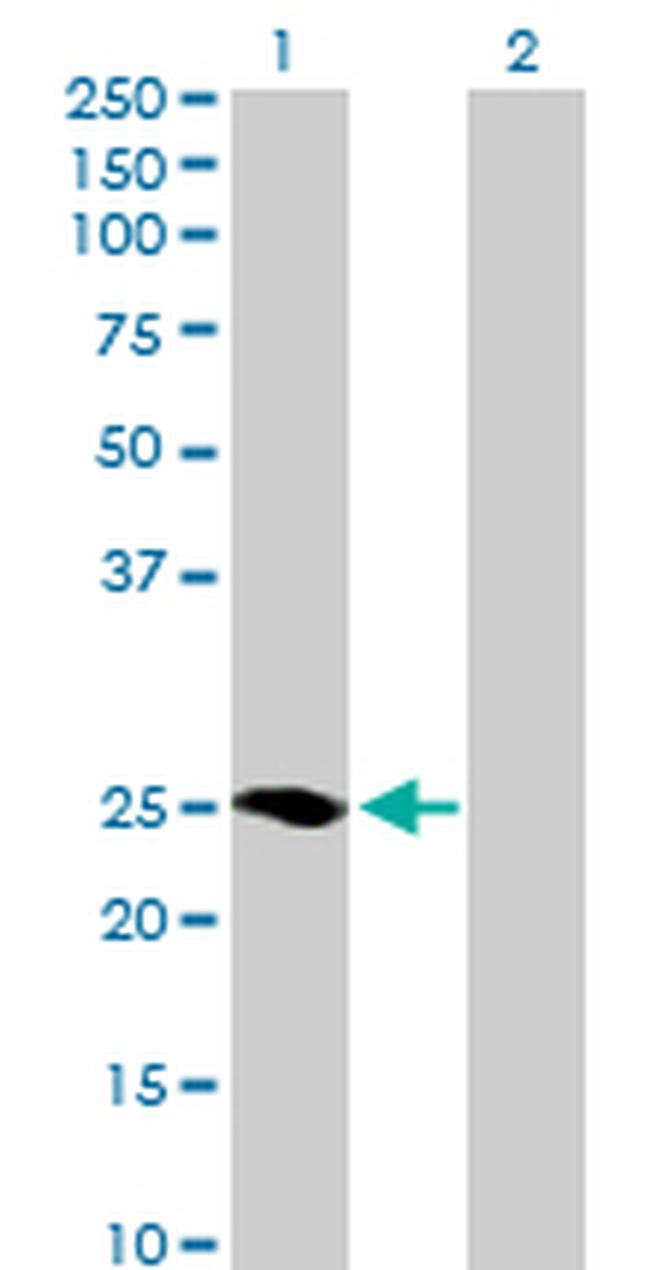 MRAS Antibody in Western Blot (WB)