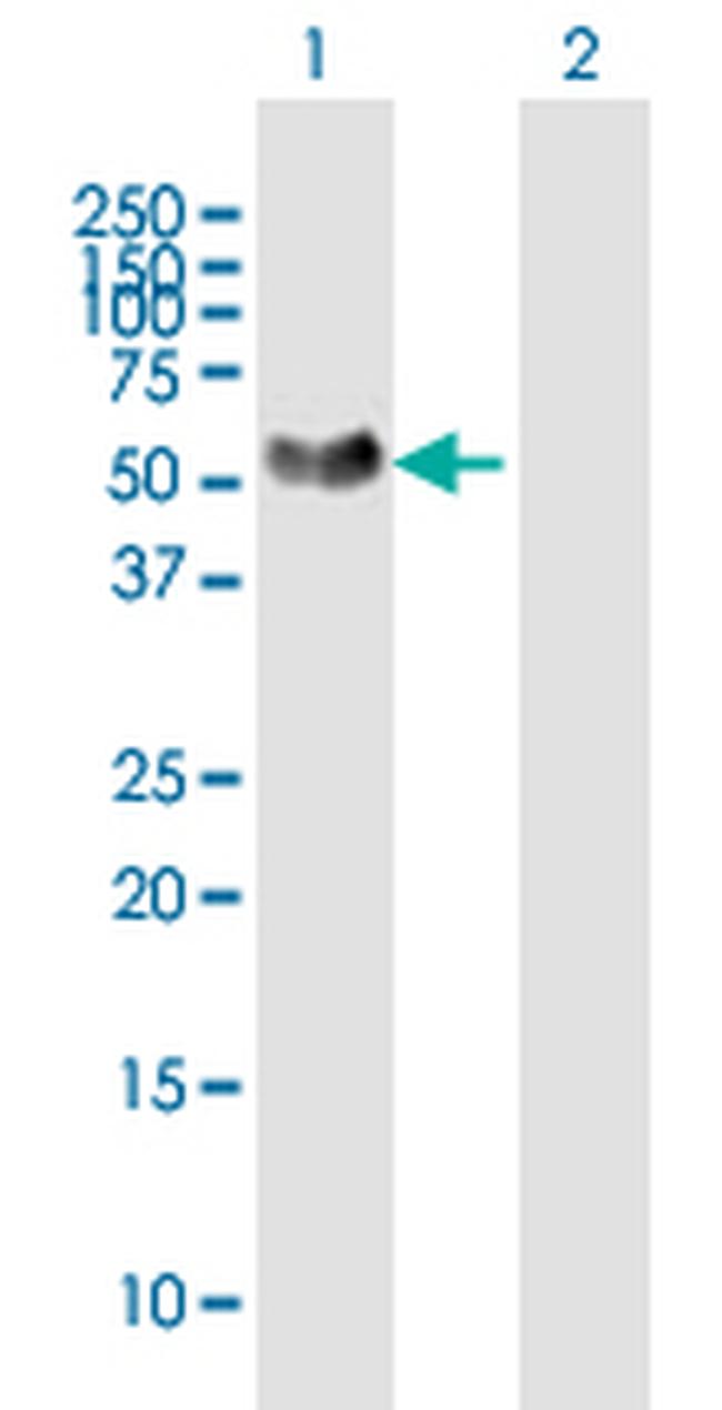 NTNG1 Antibody in Western Blot (WB)