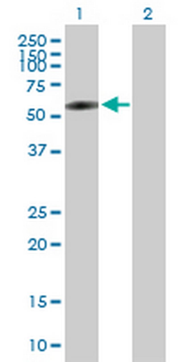 BTBD3 Antibody in Western Blot (WB)