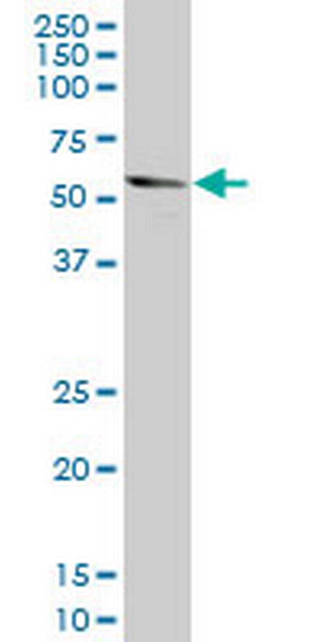 DKK1 Antibody in Western Blot (WB)