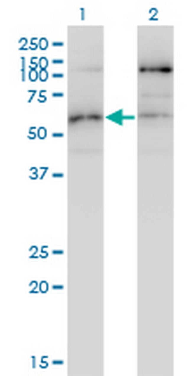 STK38L Antibody in Western Blot (WB)