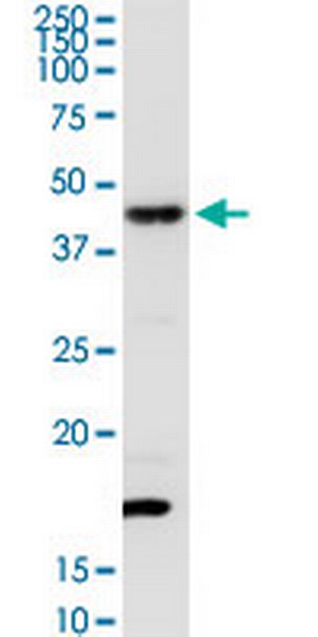 TXNDC4 Antibody in Western Blot (WB)