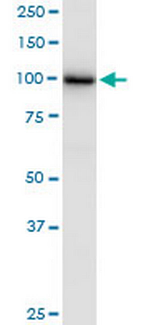 GANAB Antibody in Western Blot (WB)