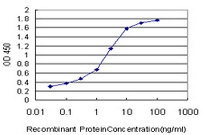 PIP5K1C Antibody in ELISA (ELISA)