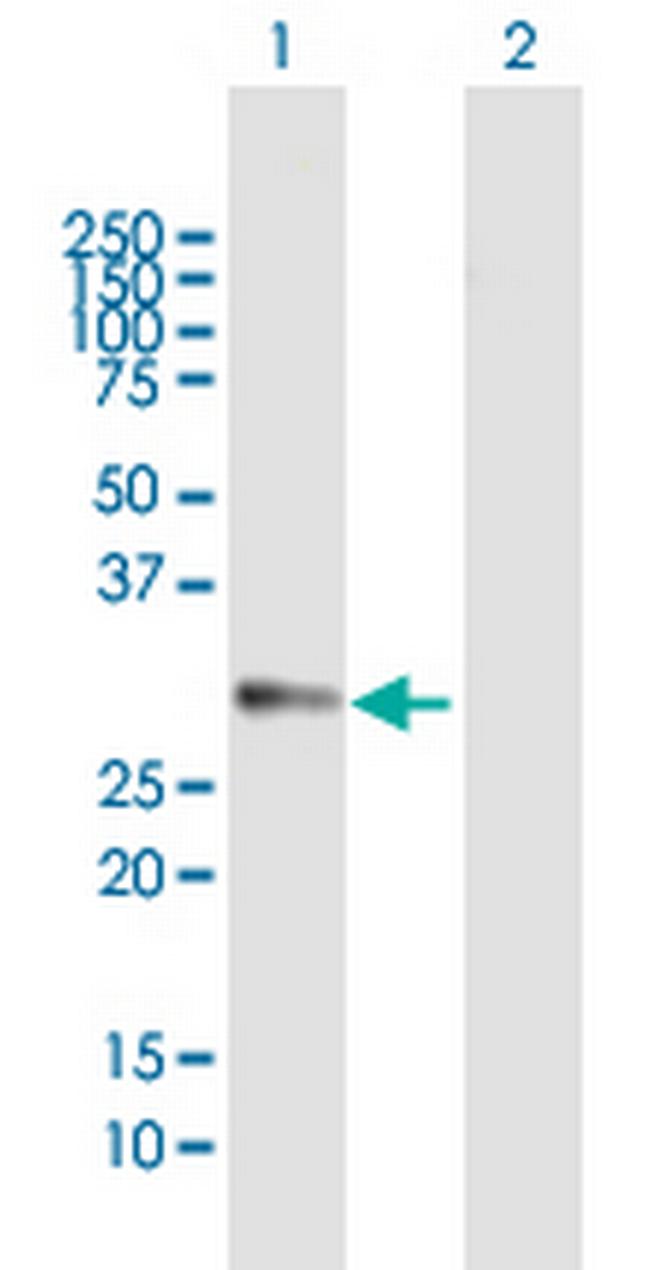 DDAH2 Antibody in Western Blot (WB)