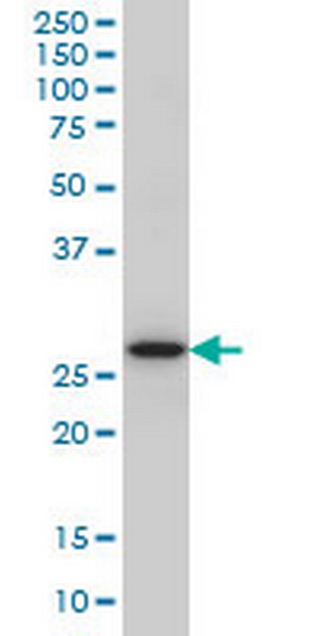CASP14 Antibody in Western Blot (WB)