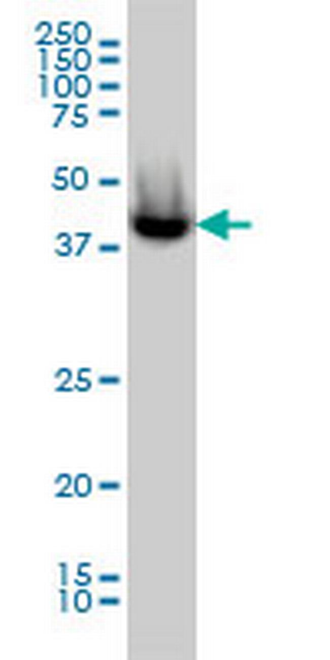 ACATE2 Antibody in Western Blot (WB)