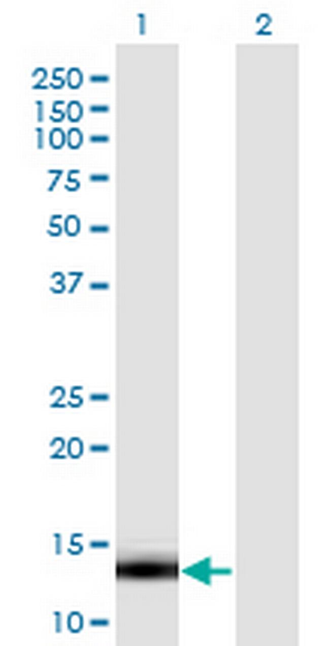 LDOC1 Antibody in Western Blot (WB)