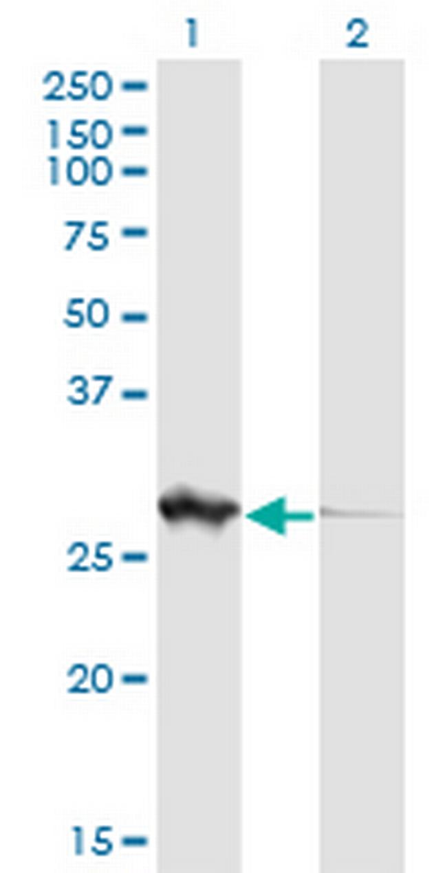 PGLS Antibody in Western Blot (WB)