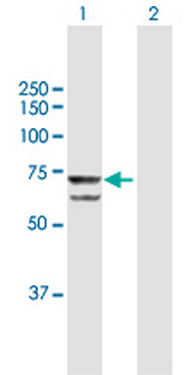 PRPF31 Antibody in Western Blot (WB)