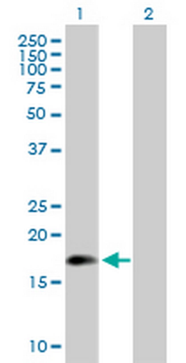 ARL5A Antibody in Western Blot (WB)