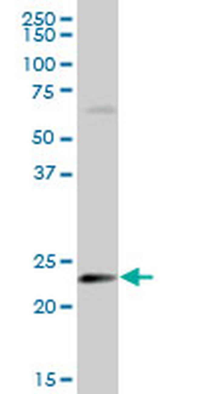 HSPB8 Antibody in Western Blot (WB)