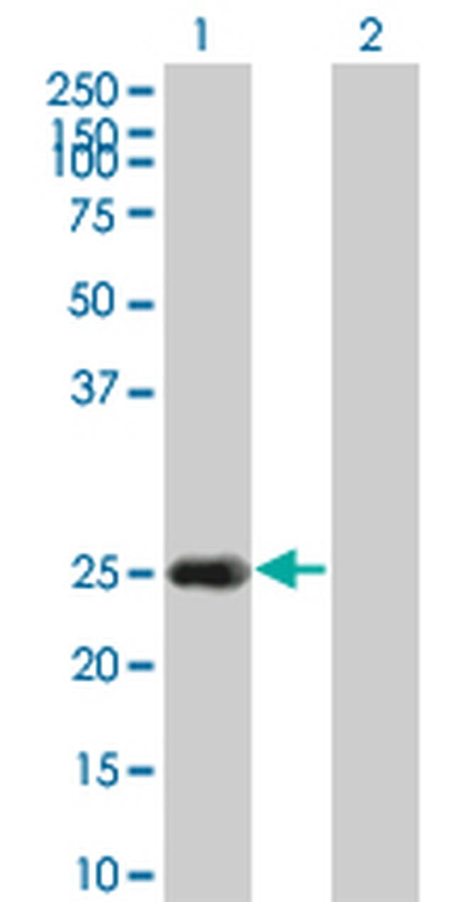 HSPB8 Antibody in Western Blot (WB)