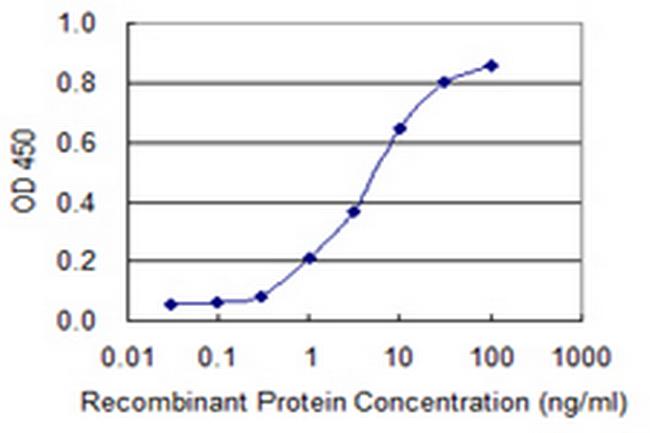 TIMM8B Antibody in ELISA (ELISA)