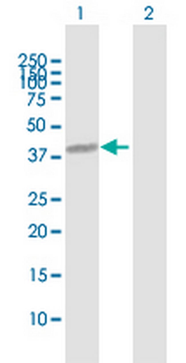 NUFIP1 Antibody in Western Blot (WB)