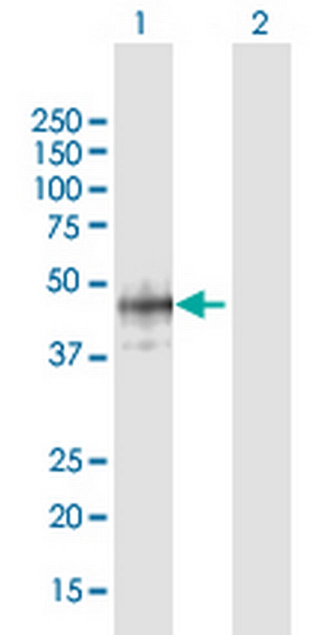 B3GAT1 Antibody in Western Blot (WB)