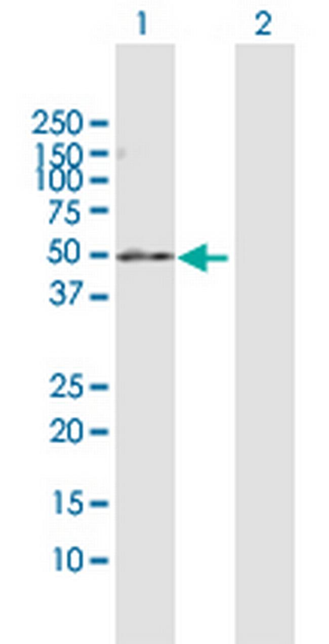 PDE7B Antibody in Western Blot (WB)