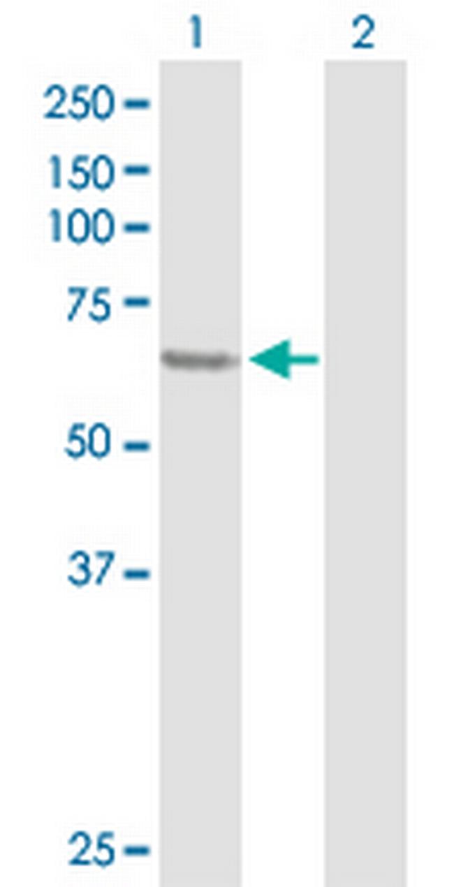 SESN1 Antibody in Western Blot (WB)