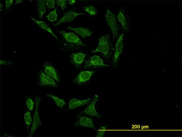 HTRA2 Antibody in Immunocytochemistry (ICC/IF)