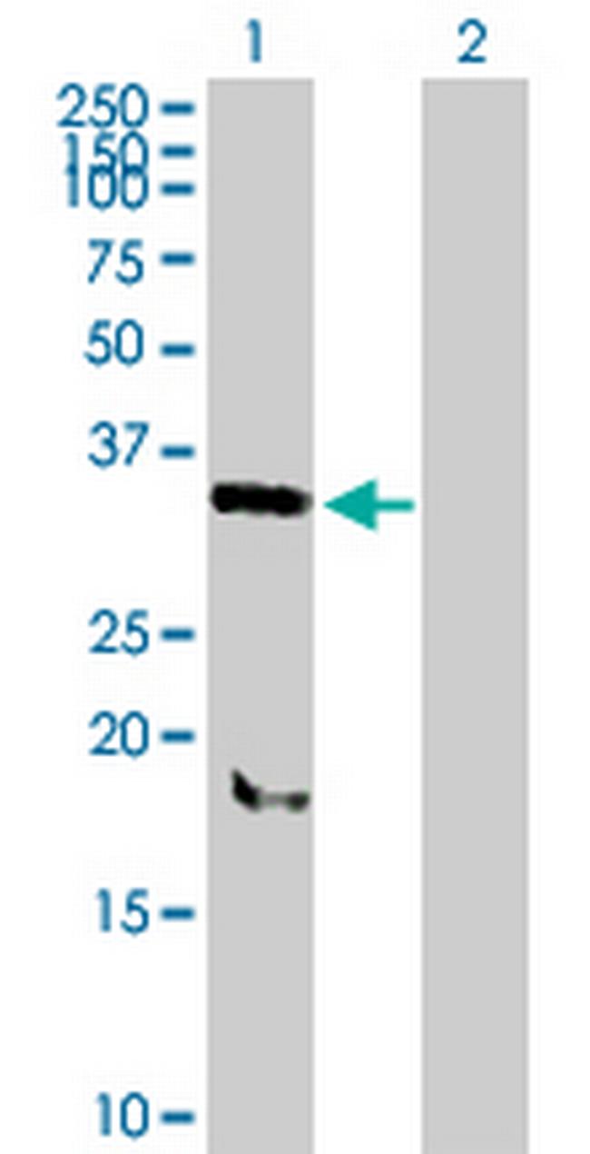 SNX11 Antibody in Western Blot (WB)