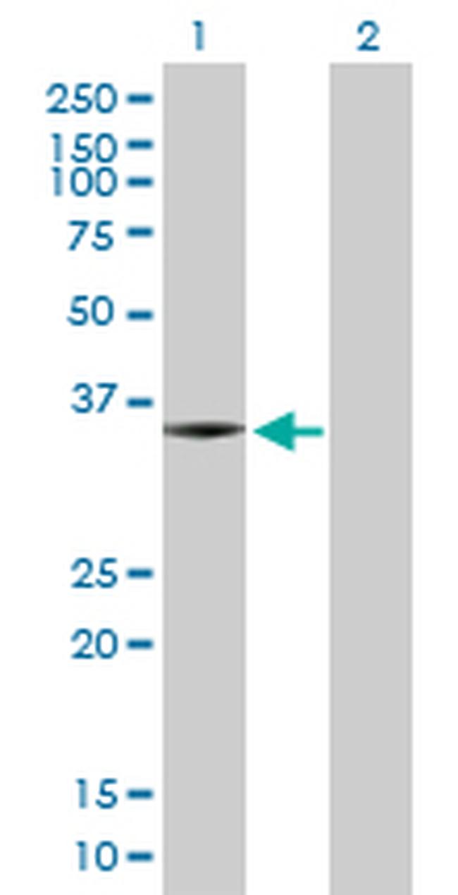 SNX11 Antibody in Western Blot (WB)