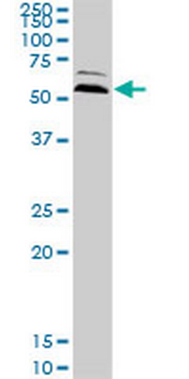 UBQLN2 Antibody in Western Blot (WB)