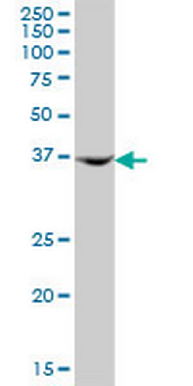 AMDHD2 Antibody in Western Blot (WB)