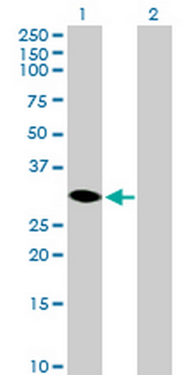 HSD17B14 Antibody in Western Blot (WB)