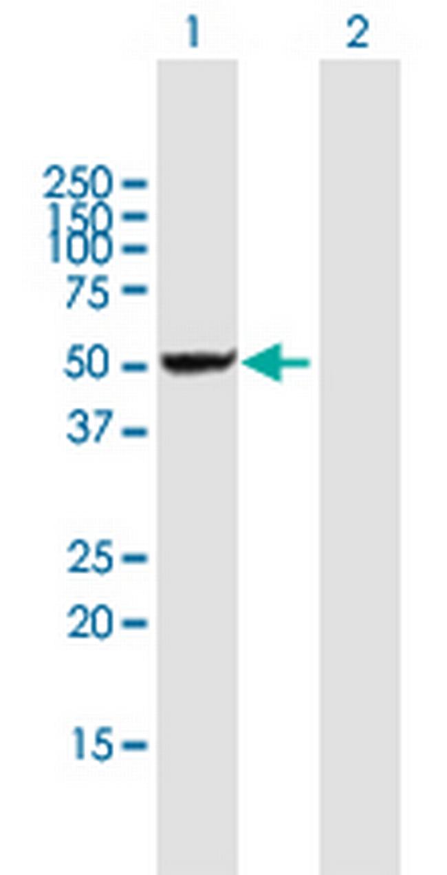 DDX47 Antibody in Western Blot (WB)