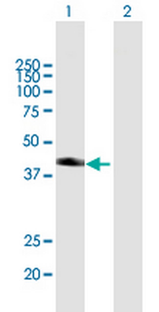 SNX7 Antibody in Western Blot (WB)